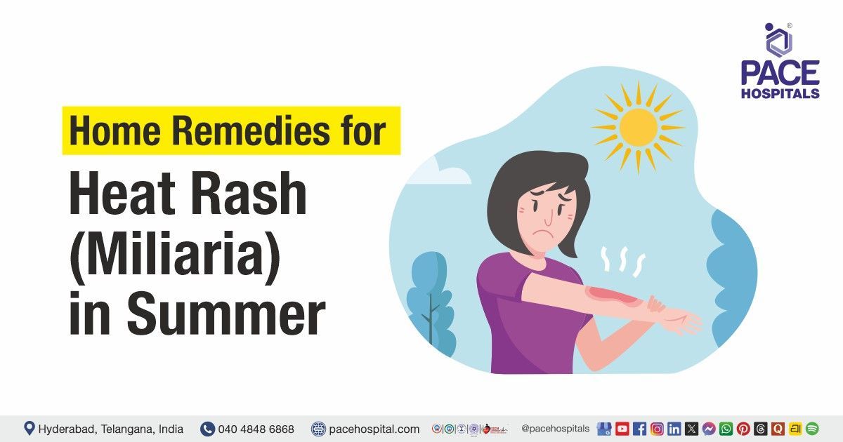 Heat rash home remedies | Prickly heat rash treatment | Heat rash treatment at home
