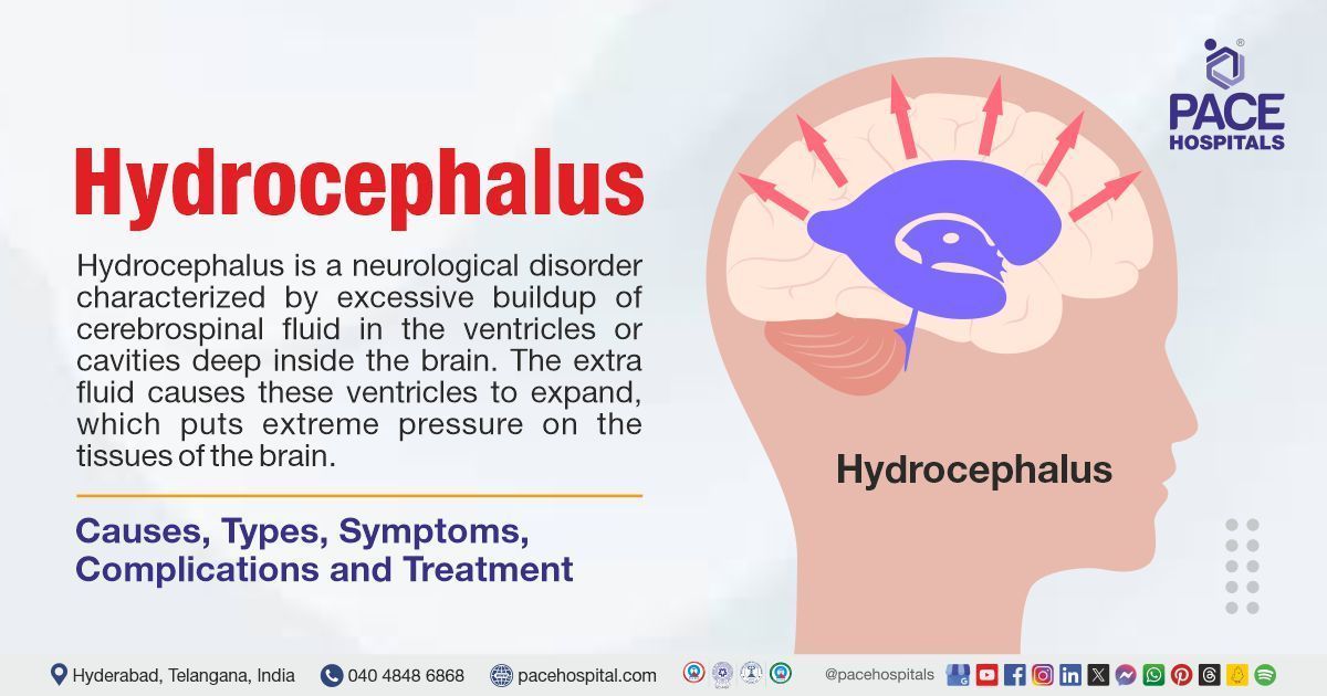 Hydrocephalus causes & symptoms | Hydrocephalus treatment in India | Hydrocephalus meaning