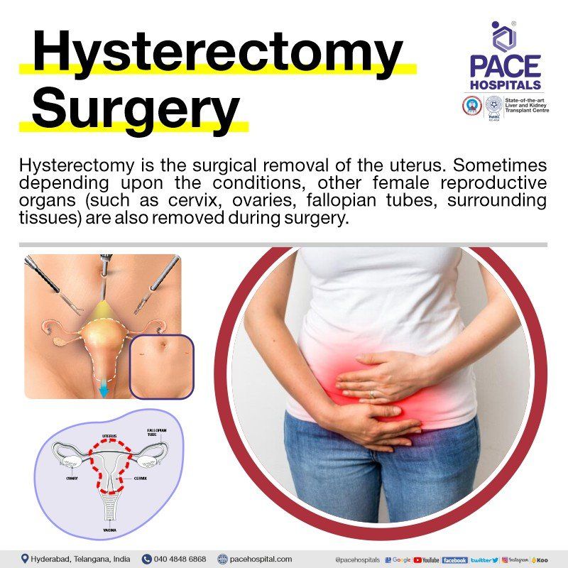 Hysterectomy in Hyderabad | Hysterectomy in India | Uterus removal surgery | Hysterectomy surgery | Uterus removal surgery cost | Hysterectomy cost | laparoscopic hysterectomy | vaginal hysterectomy | total hysterectomy | abdominal hysterectomy | robotic hysterectomy