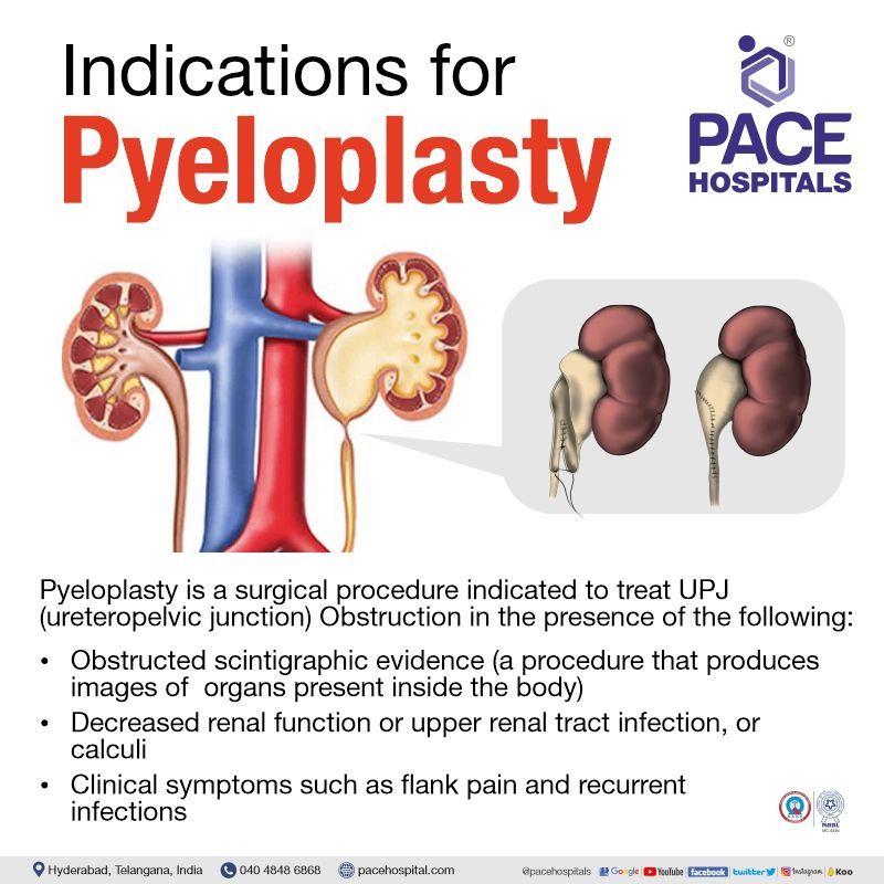 indications for pyeloplasty surgery | laparoscopic pyeloplasty procedure in Hyderabad | robotic pyeloplasty cost in India