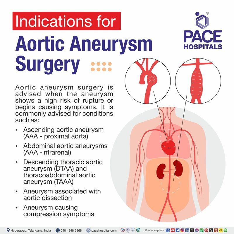 Aortic aneurysm surgery indications | Visual depicting the indications of surgery in aortic aneurysm