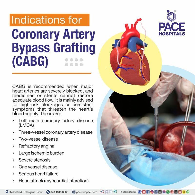 Indications of CABG CABG Indications | visual depicting Coronary artery bypass grafting indications
