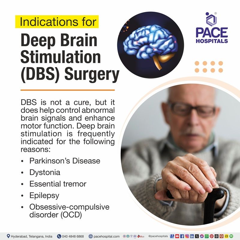 Indications of Deep Brain Stimulation Surgery Visual depicting the indications of Deep brain stimulation surgery | in what caes DBS is suggested