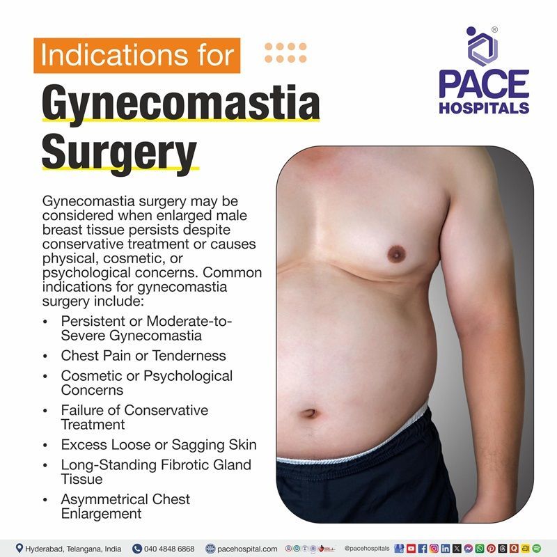 image depicting the signs and circumstances of Gynecomastia Surgery | Gynecomastia Surgery indications