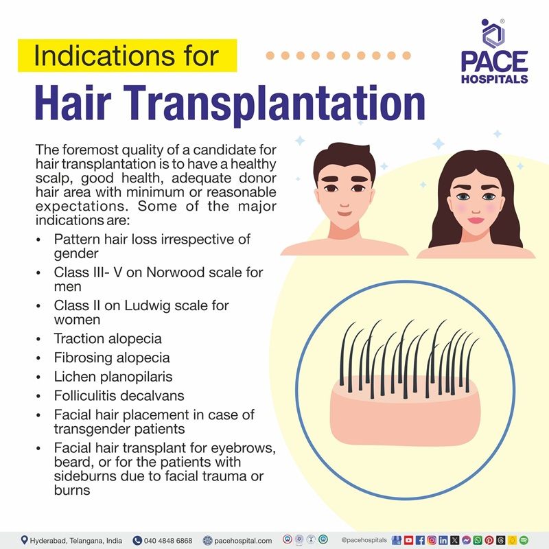 hair transplant indications | hair transplant price in India | hair transplant before and after | hair transplantation in Hyderabad India