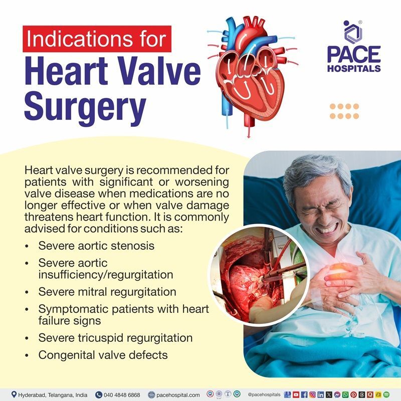 Indications of Heart Valve Replacement Surgery in Hyderabad, India