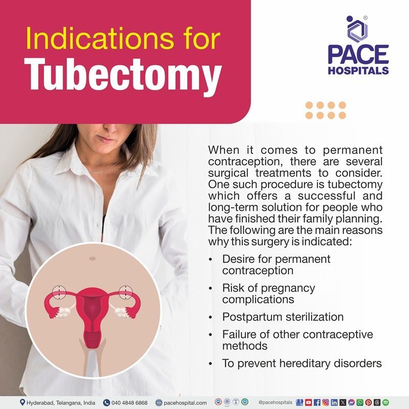 Indications for Tubectomy Operation | Tubal Ligation Surgery Indications