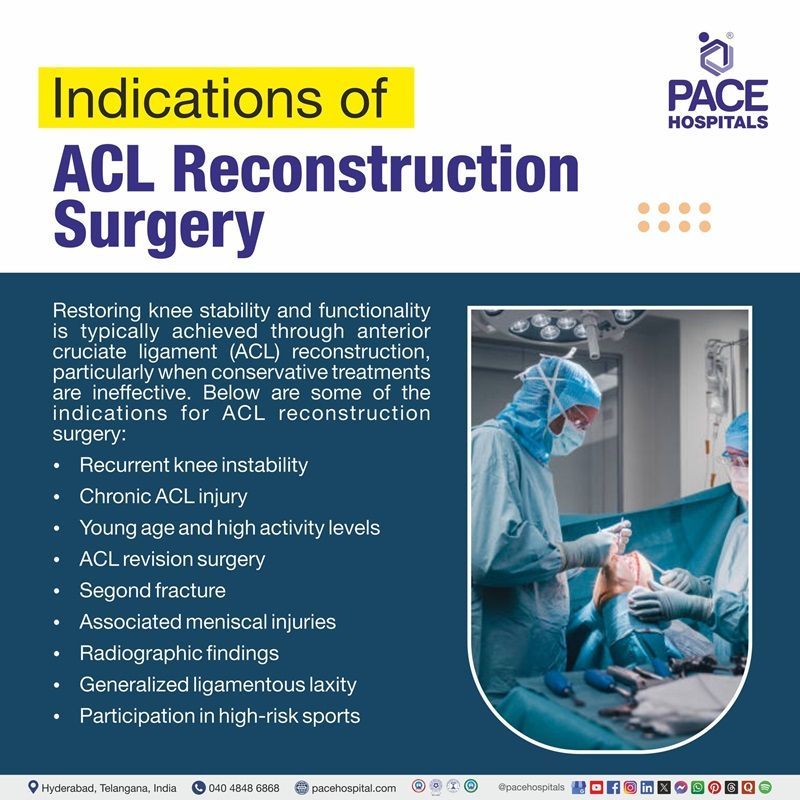 Indications of ACL Reconstruction ACL Reconstruction Indications | Indications of ACL Reconstruction | Visual depicting the Indications of ACL Reconstruction