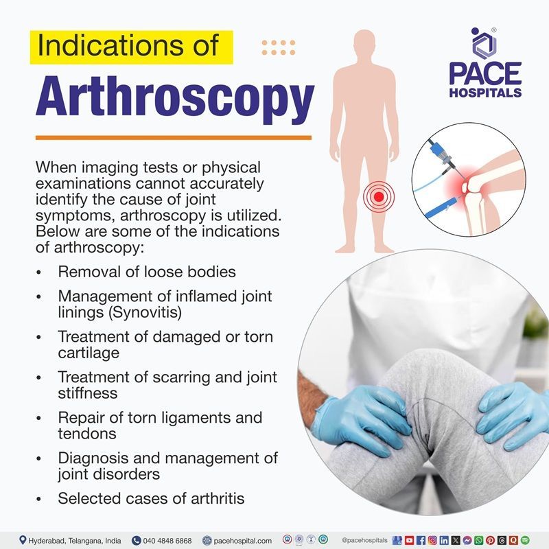 Arthroscopy indications​ | indications of arthroscopy
