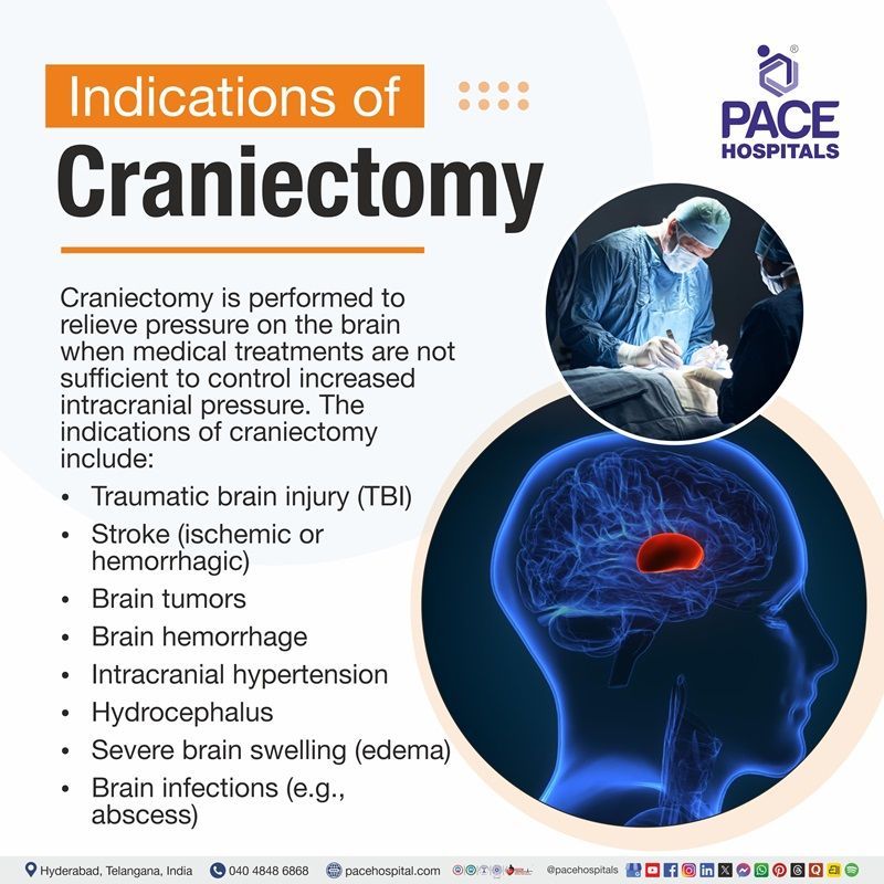 Indications of Craniectomy Visual depictijg the indications of craniectomy | illustration showing the signs for craniectomy surgery