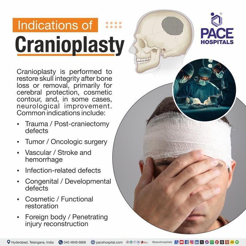 Visual depictijg the indications of Cranioplasty | medical illustration showing the signs for Cranioplasty surgery