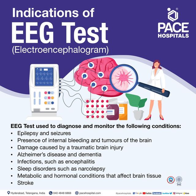 Eeg Test In Hyderabad - Procedure Indications, Types And Scan Cost