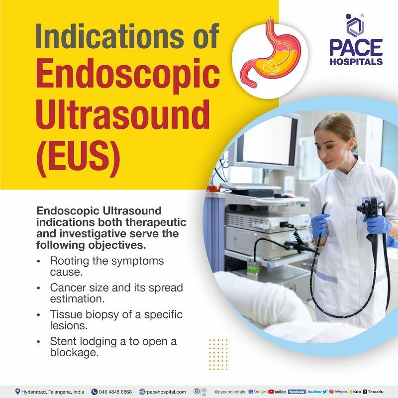 EUS endoscopic ultrasound uses | what is endoscopic ultrasound used for | eus surgery in Hyderabad, India | endoscopic ultrasound gallstones | endoscopic ultrasound pancreas biopsy