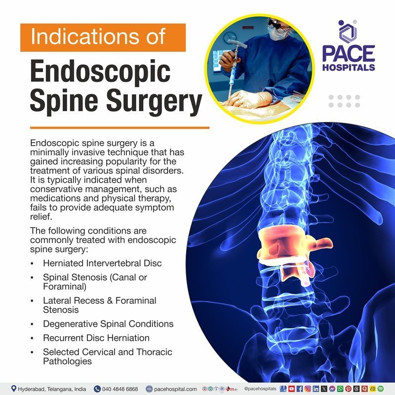 Endoscopic spine surgery indications with highlighted lumbar disc image | indications Endoscopic spine surgery