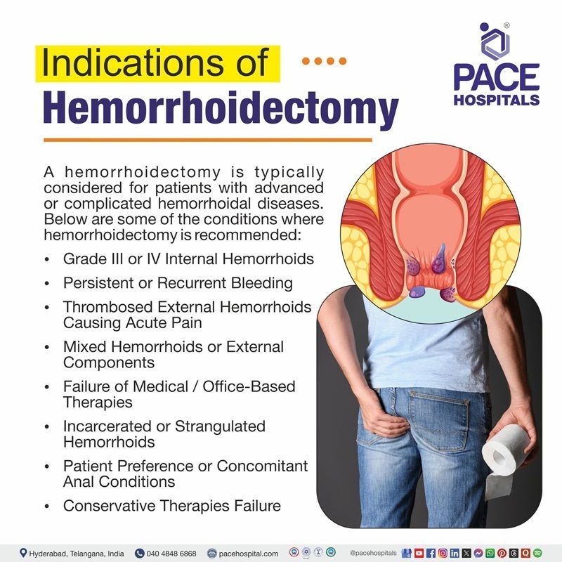 hemorrhoidectomy indications​ | indications​ of hemorrhoidectomy | What are the indications​ of hemorrhoidectomy