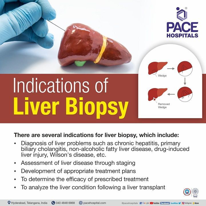 liver biopsy indications | liver biopsy test in hyderabad, india