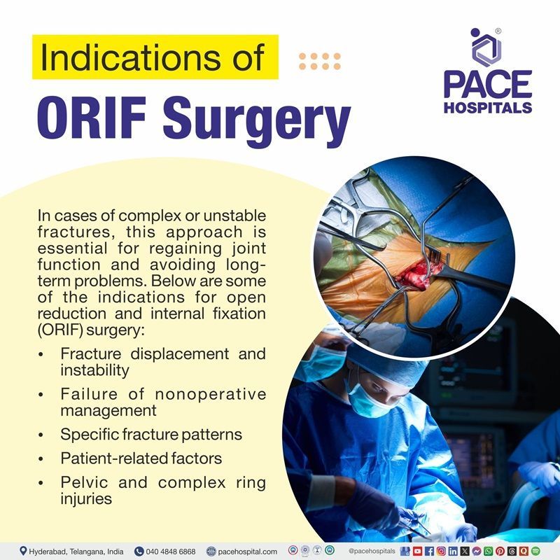 Visual depicting ORIF Surgery Indications | ORIF Surgery Signs