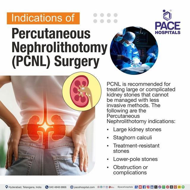 Percutaneous Nephrolithotomy Procedure Steps