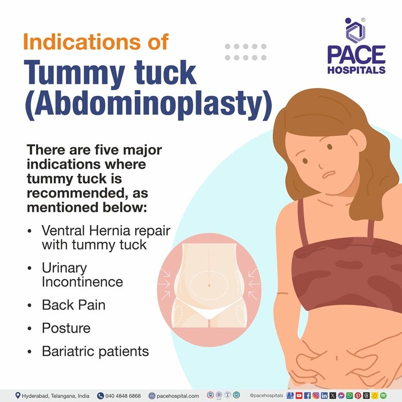 abdominoplasty indication | indication of abdominoplasty | what are the indications of abdominoplasty | Tummy tuck indication | Visual text showing the indication of Tummy tuck 