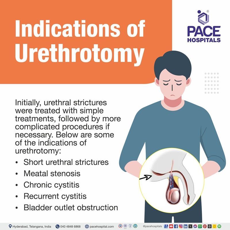 indications of Urethrotomy | urethrotomy surgery indication | good candidate for urethrotomy | ideal candidate for Urethrotomy | endoscopic urethrotomy cost in Hyderabad, India