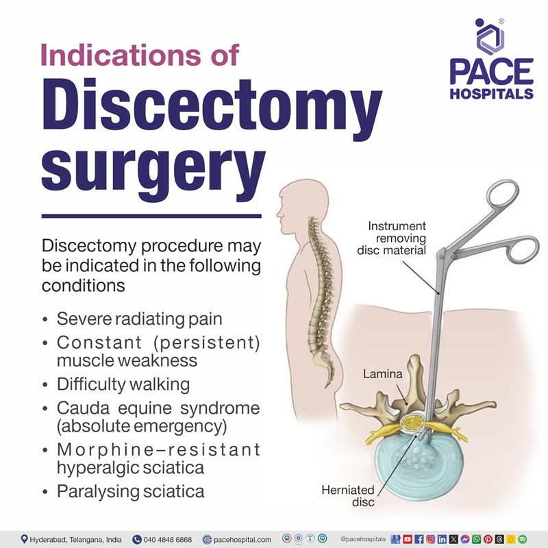 Indications of Discectomy surgery​ or procedure