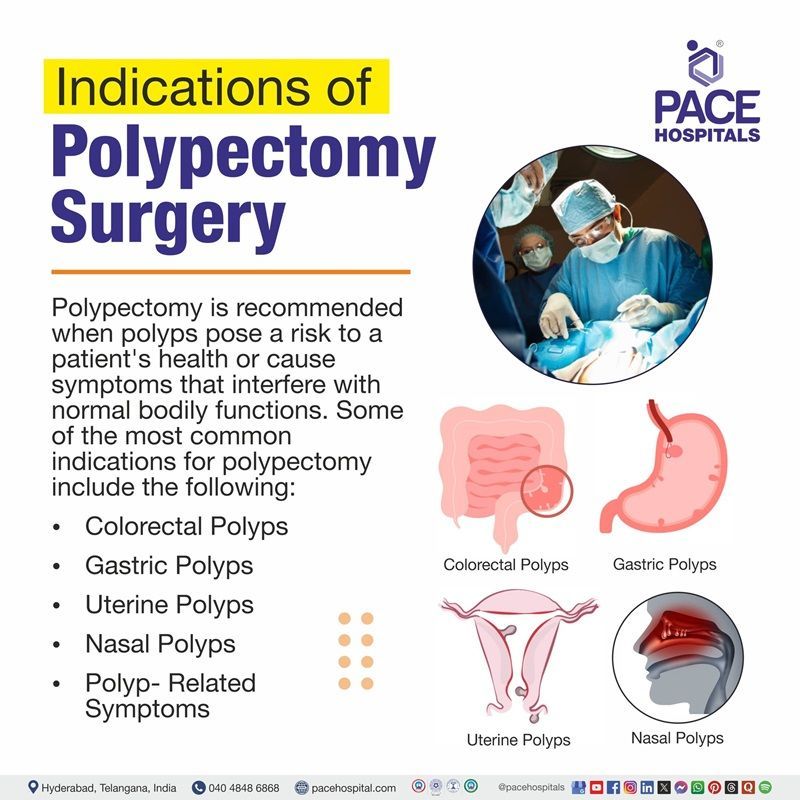 When is a polypectomy indicated | Polyps Removal Surgery Indications | Endoscopic Polypectomy Indications