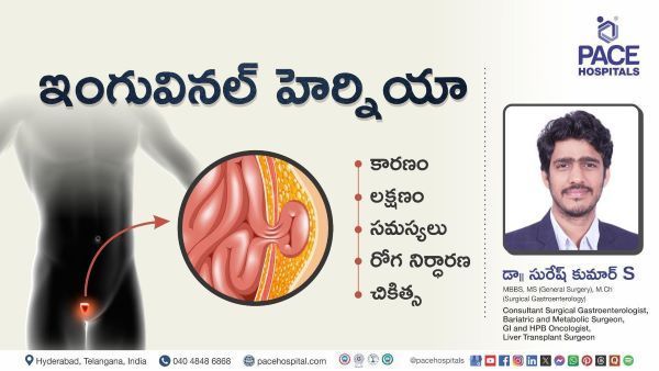 Inguinal Hernia Symptoms &Treatment explained in telugu Dr Suresh Kumar from PACE Hospitals