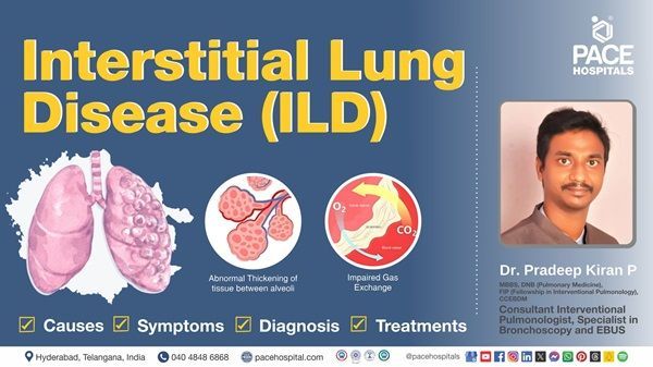 Dr. Pradeep Kiran explains interstitial lung disease ILD causes, symptoms, diagnosis & treatment