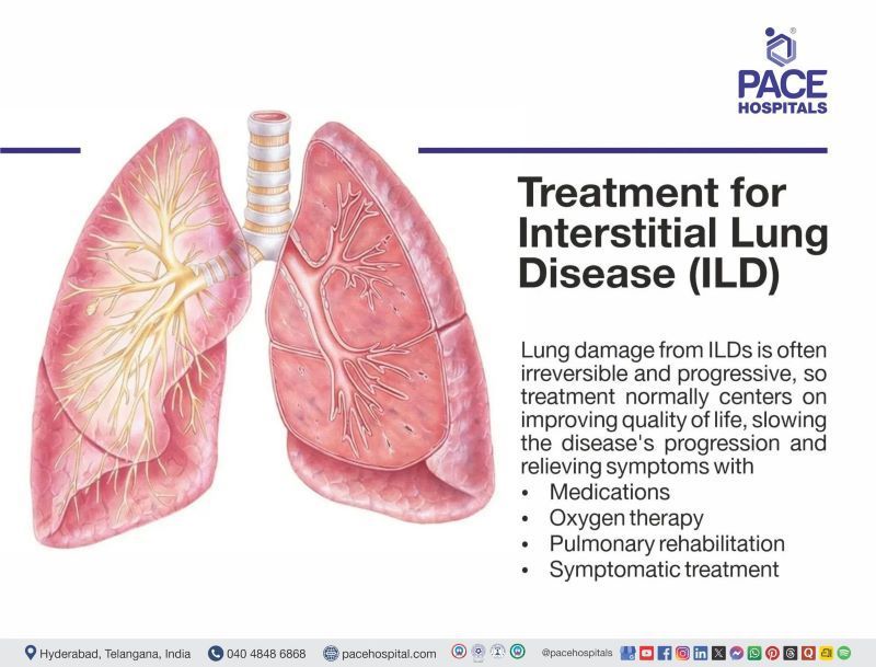 interstitial lung disease treatment | interstitial lung disease alternative treatment | ILD disease treatment in India | ILD disease treatment | treatment of ILD | Visual depicting the treatment of  Interstitial lung disease
