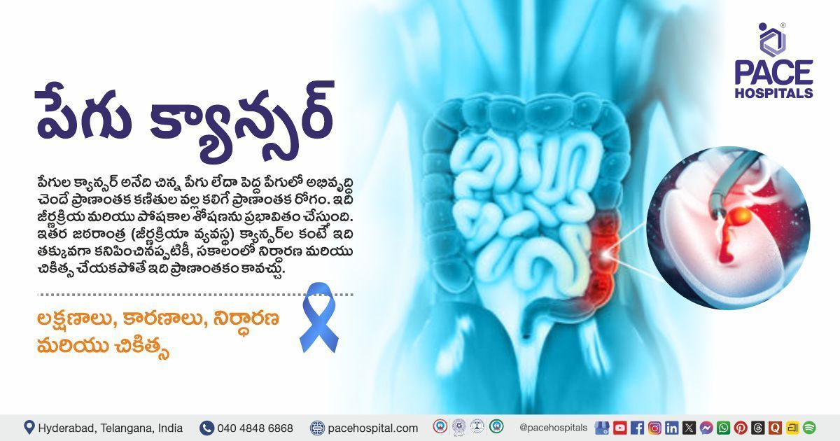 Intestinal Cancer Symptoms, Causes, Diagnosis & Treatment in Telugu | Intestinal Cancer in Telugu