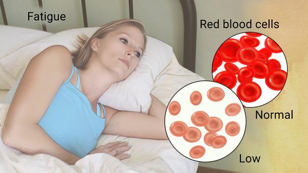 What is Iron Deficiency Anemia?