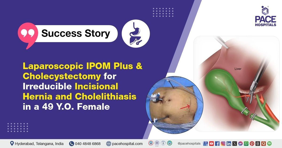 Case study of a woman suffering with incisional hernia and gallstones treated at PACE Hospitals, Hyd