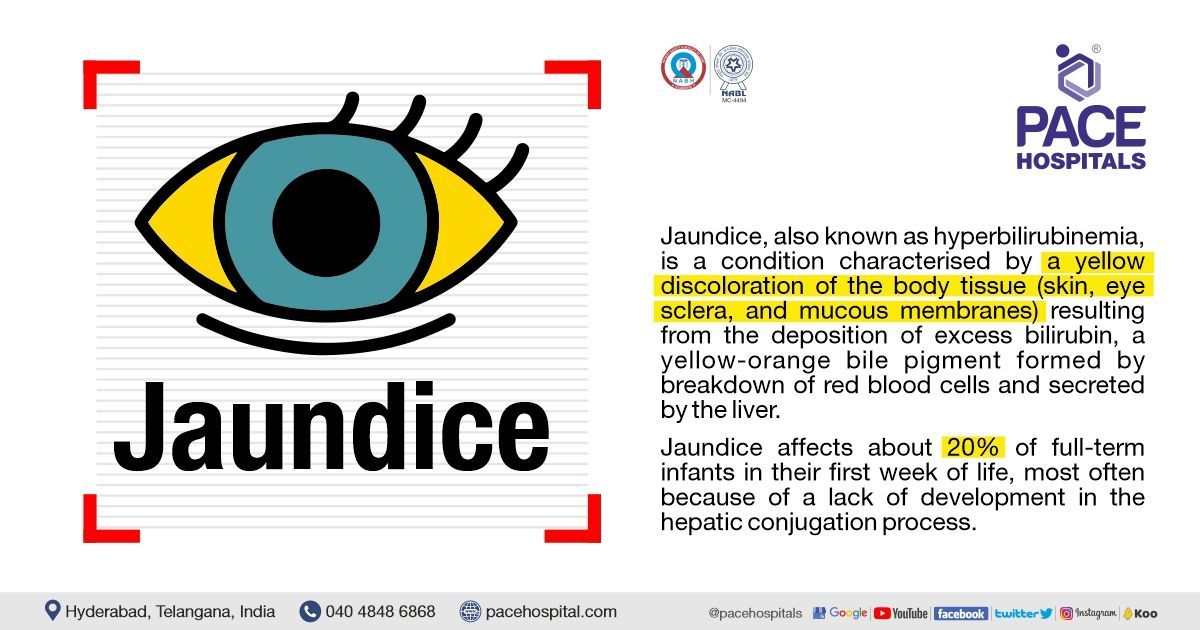 Jaundice: Causes, symptoms, and treatments