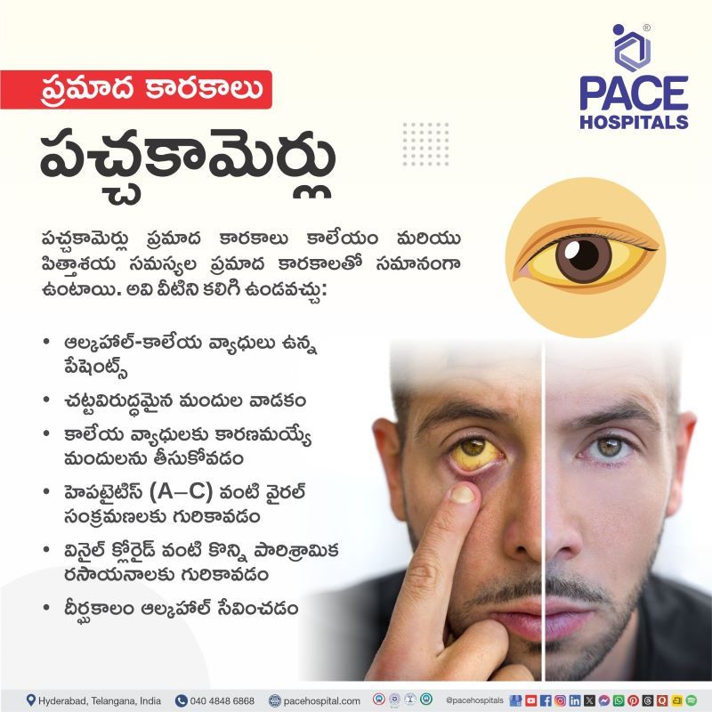 పచ్చకామెర్లు ప్రమాద కారకాలు | Complications of Jaundice in Telugu Jaundice Complications in Telugu | పచ్చకామెర్లు ప్రమాద కారకాలు | Complications of Jaundice