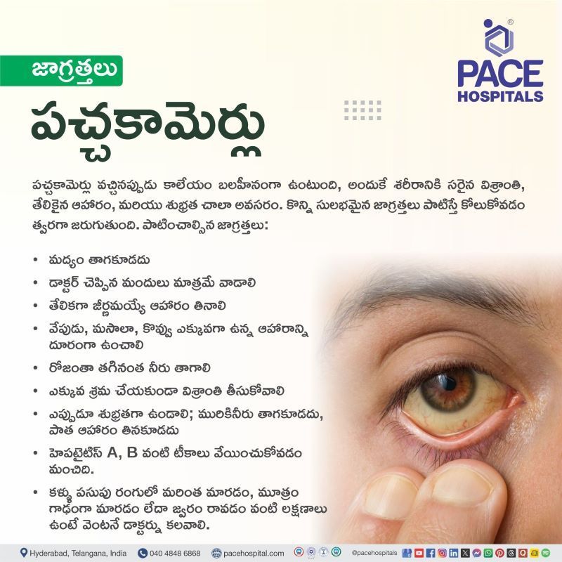 పచ్చకామెర్లు జాగ్రత్తలు | Jaundice Precautions in Telugu Jaundice Precautions in Telugu | పచ్చకామెర్లు జాగ్రత్తలు | Precautions of Jaundice in Telugu