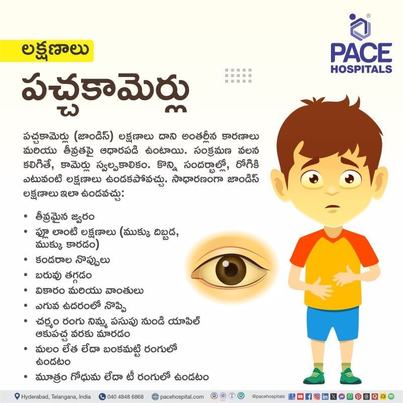 పచ్చకామెర్లు లక్షణాలు | Jaundice Symptoms in Telugu Jaundice Symptoms in Telugu | పచ్చకామెర్లు లక్షణాలు | Jaundice Symptoms Telugu