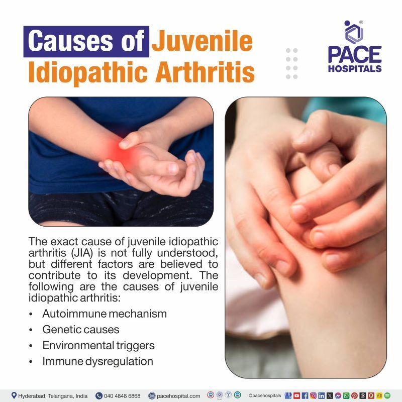Juvenile Idiopathic Arthritis Causes | What causes juvenile idiopathic rheumatoid arthritis
