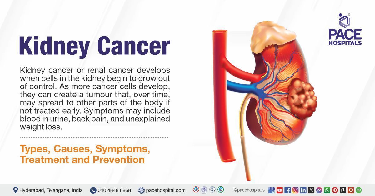 Kidney Cancer Causes & Symptoms | Kidney cancer treatment in India | Kidney Cancer Prevention