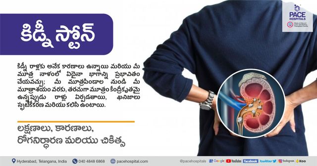 Brain Stroke Types Causes Symptoms Prevention And Treatment