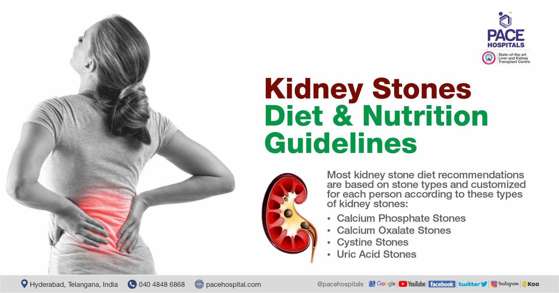 types of kidney stones