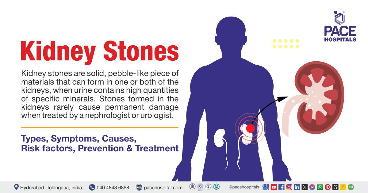 Kidney stones symptoms and causes | Kidney stones treatment in India | What causes Kidney stones