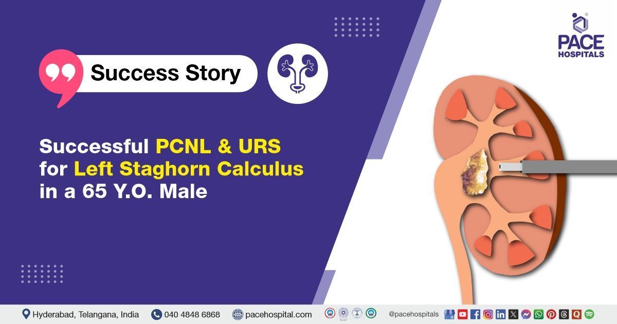 Case study of a 65 Y.O. male with left staghorn calculus successfully treated at PACE Hospitals