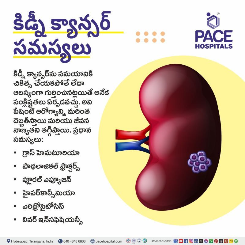 Kidney Cancer Complications in Telugu | కిడ్నీ క్యాన్సర్ సమస్యలు | Complications of Kidney Cancer in Telugu
