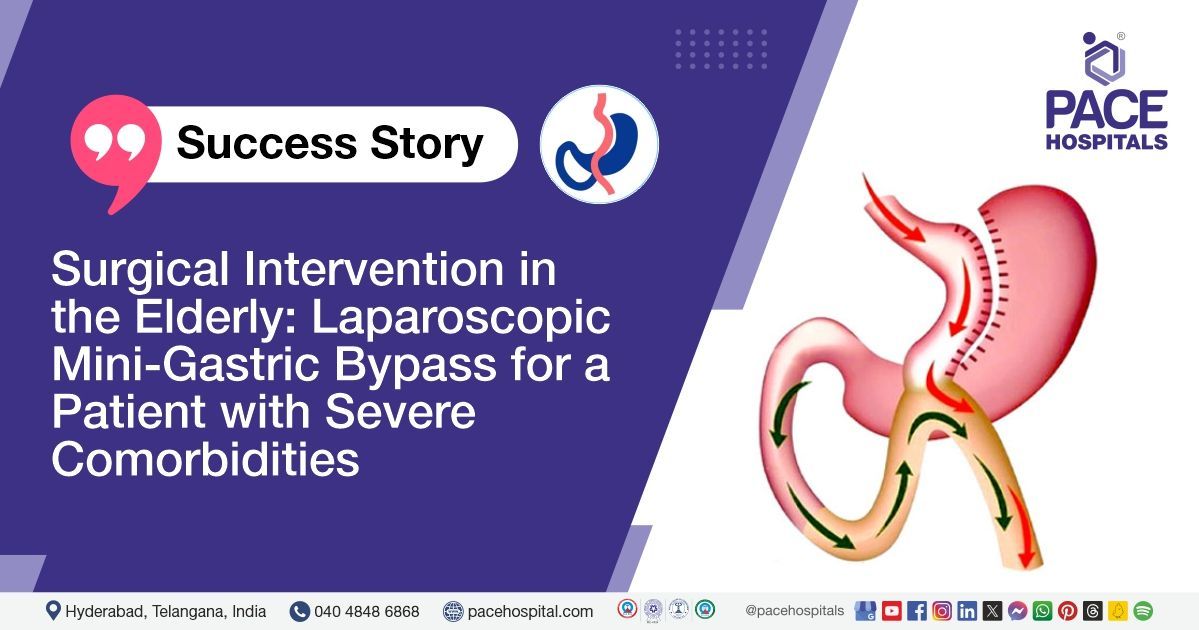 Case study of a 60-YO male patient who underwent laparoscopic mini-gastric bypass at PACE Hospitals