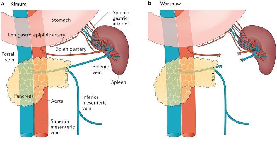 Distal Pancreas Anatomy