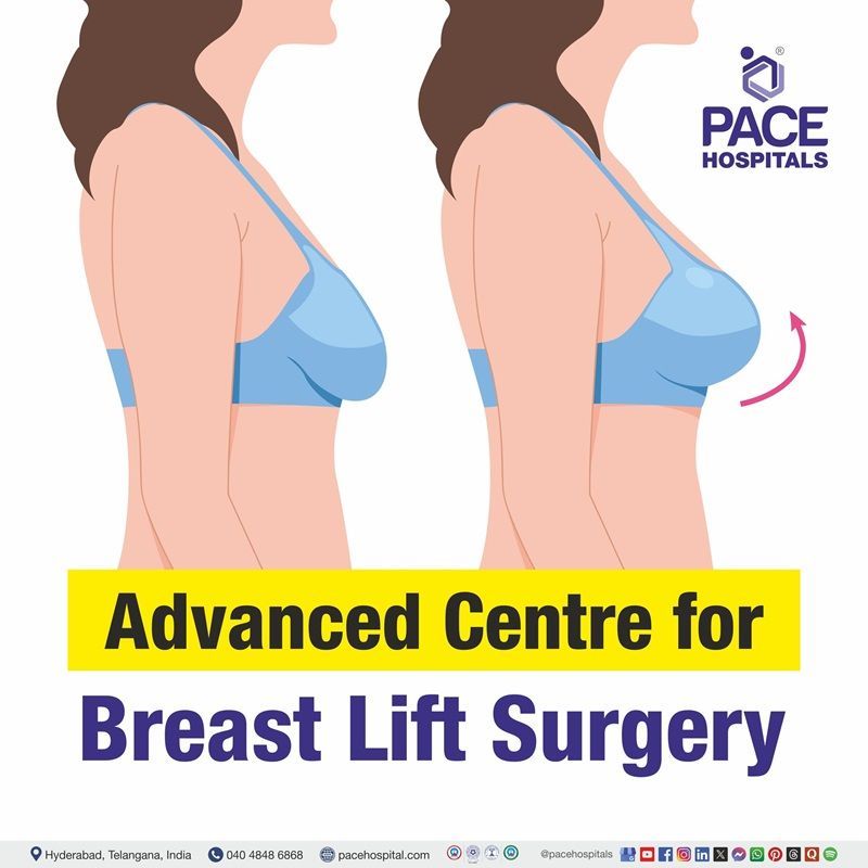 Best hospital for breast lift surgery in Hyderabad | breast lift surgery near me