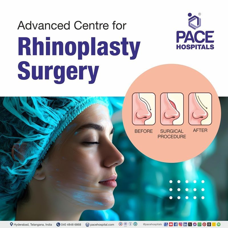 best hospital for rhinoplasty in Hyderabad | rhinoplasty centre in Hyderabad | rhinoplasty near me