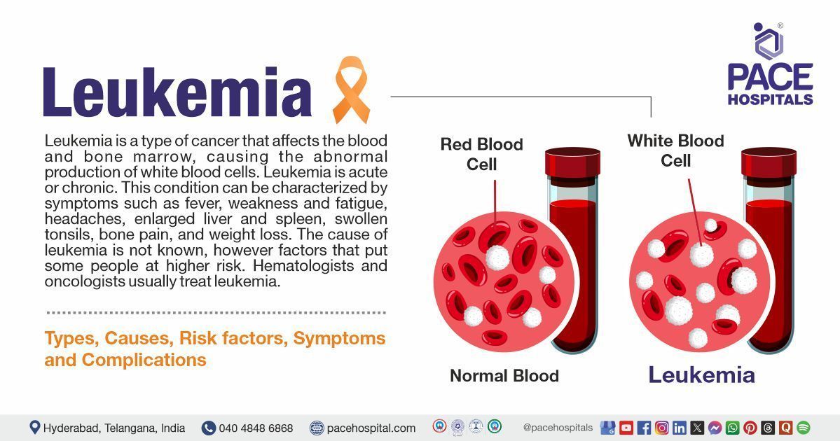 Leukemia Symptoms & Causes | Leukemia treatment in India | Leukemia meaning