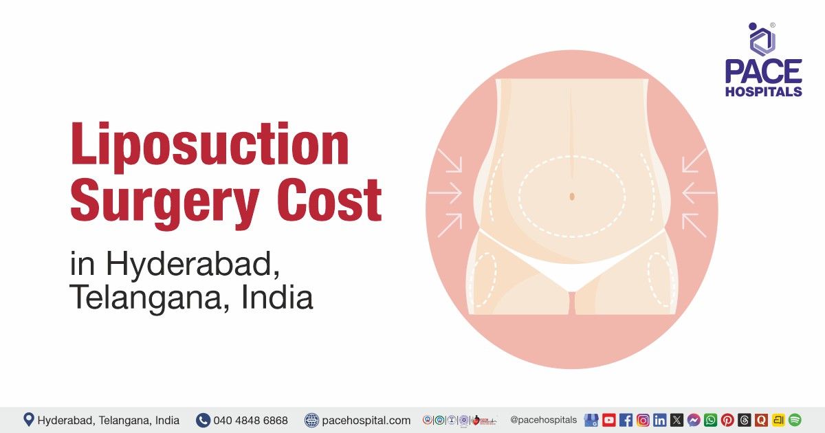 Cost Liposuction in Hyderabad at PACE Hospitals, Liposuction surgery Cost estimate