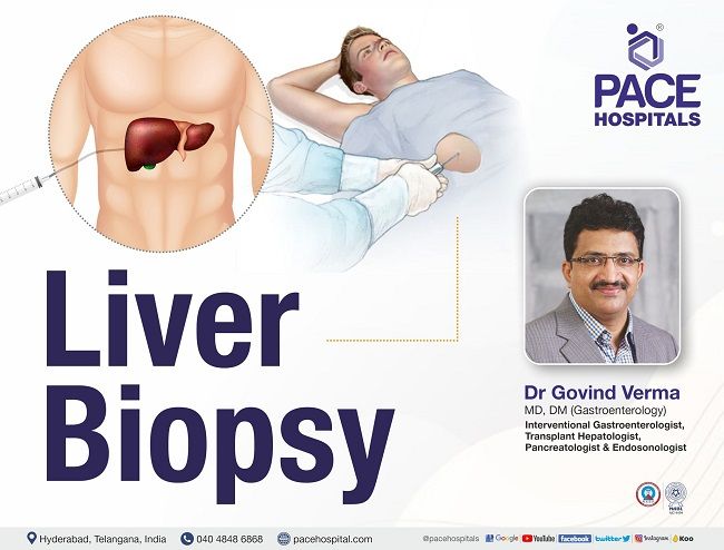 Liver Biopsy - Procedure, Indications, Complications & Advantages | Liver Biopsy Procedure